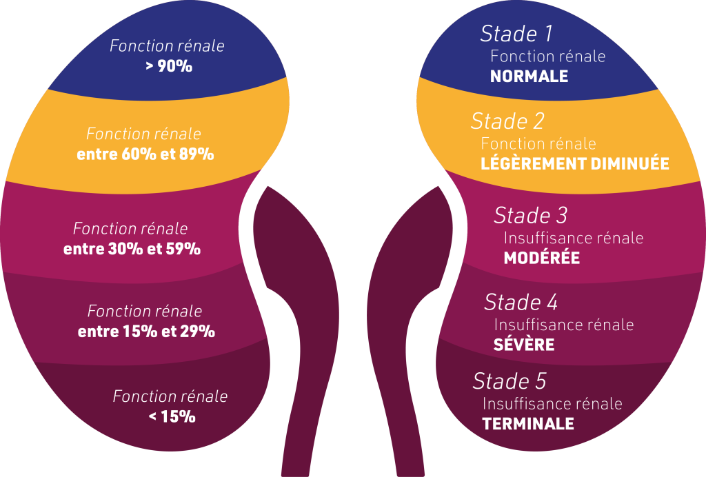 Stades de l'insuffisance rénale chronique